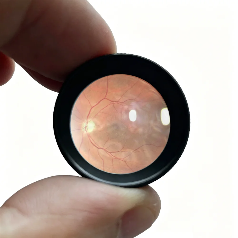 Lenti Oftalmiche Classiche ad Alta Chiarezza con Ampio Campo Visivo, Lente 90D, Lenti Oftalmiche Doppie Asferiche - Image 4