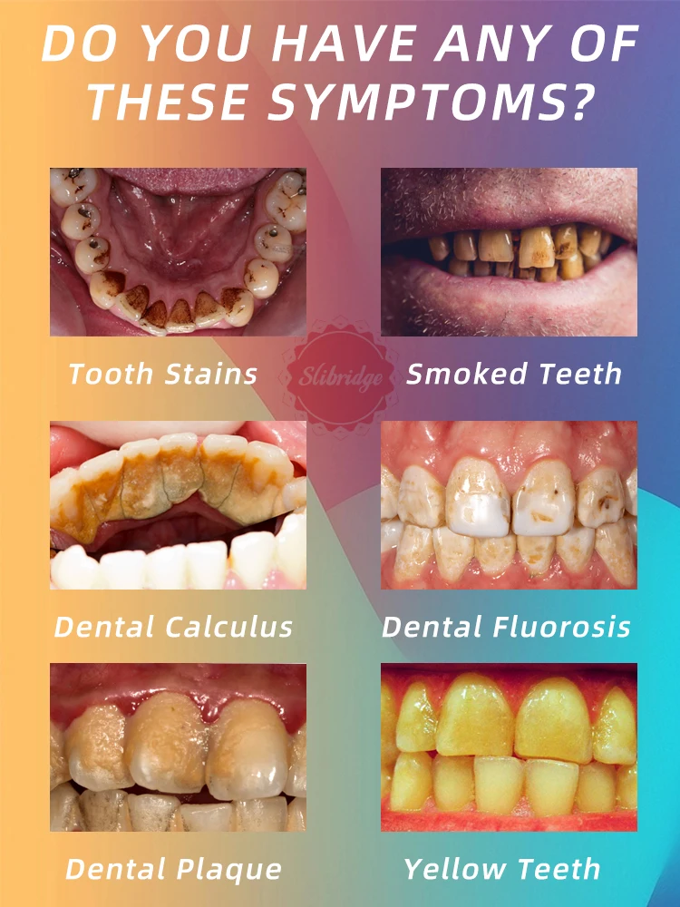 Рисунок 5 - Средство для удаления пятен с зубов