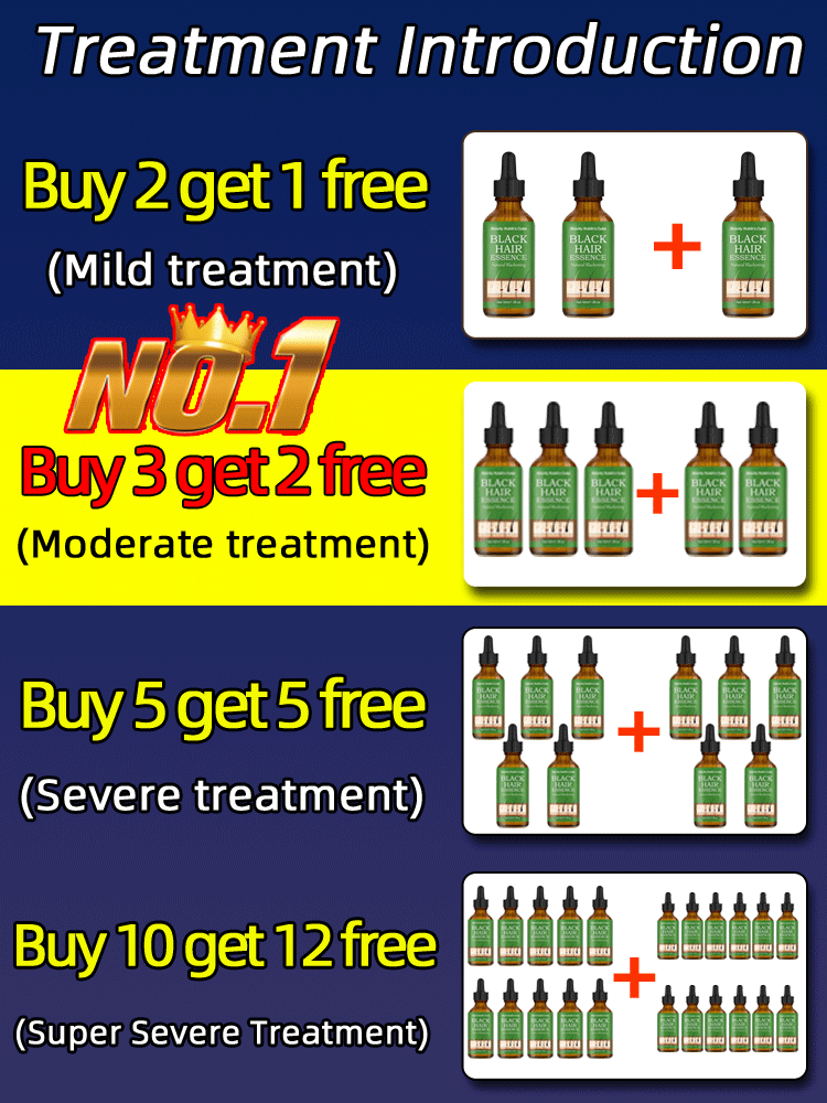 Description Picture 4 of itemAnti Gray Hair Serum