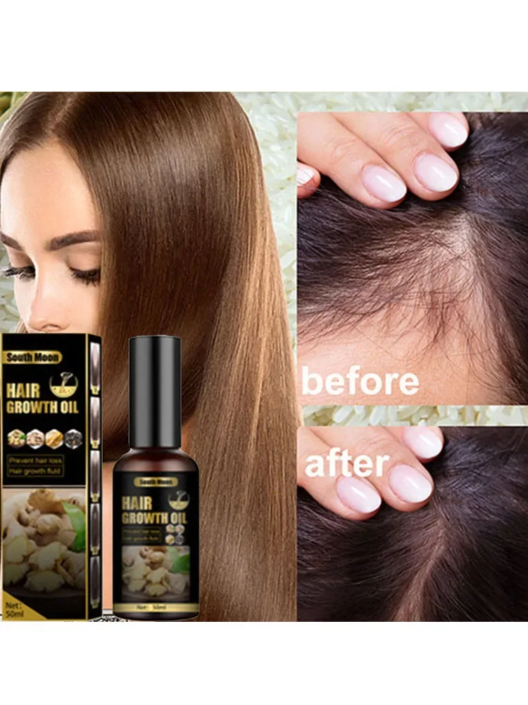 To address baldness. Anti hair loss spray anti hair loss hair nutrition growth agent essence promotes hair growth