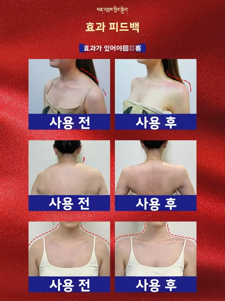 어깨 교정 요가 서클 얇은 등 미용 도구 여성용 피트니스 장비 둥근 어깨 제거 요가 및 필라테스에 이상적