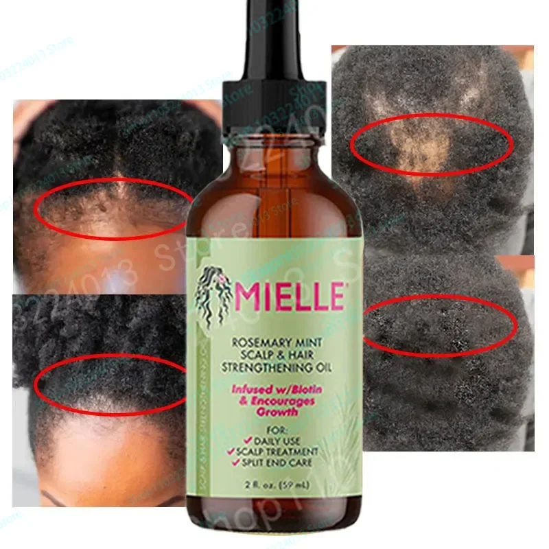 

Organics Mielle Rosemary Mint Hair Growth Essential Oil Scalp & Hair Strengthen Oil Nourishing Improve Split Ends