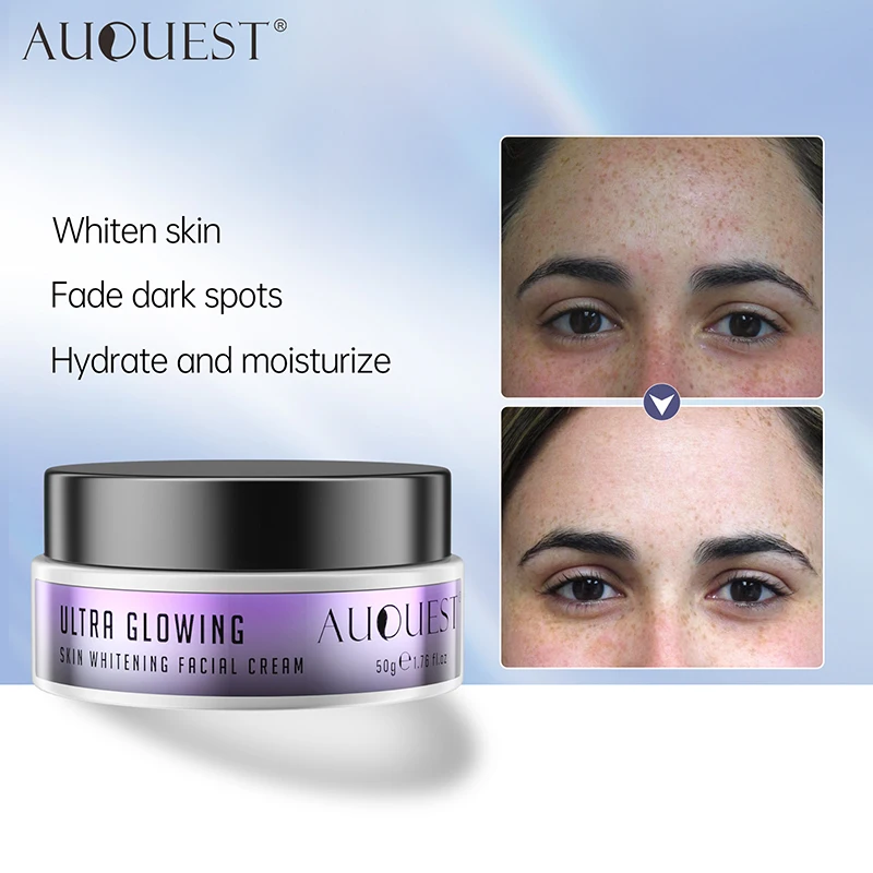 

Auquest Niacinamide Freckles Removal Dark Spot Whitening Fade Face Cream Melasma Facial Acne Spots Bright Lift Firming Skin Care