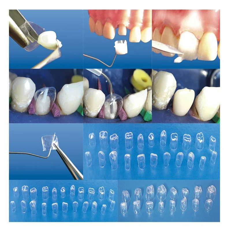 64-Piece Pre-Corona Dental Resin Preformed Temporary Crowns - Transparent, For Adults & Kids