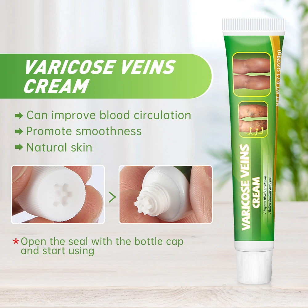 Varicose Veins Laser Treatment Cream Effective Relieve Legs Dilated Vasculitis Phlebitis Natural Formula Ointment Varicose Veins