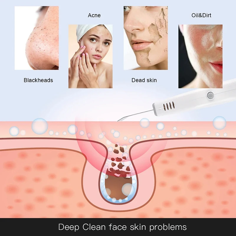 Facial Cleansing Brush Blackhead Remover Facial Cleaner Facial Scrubber Ultrasonic Cleaner Face Skin Scrubber Blackhead Remover Acne Spots Removal Facial Dirt Peeling Cleanser Beauty Lifting Massage