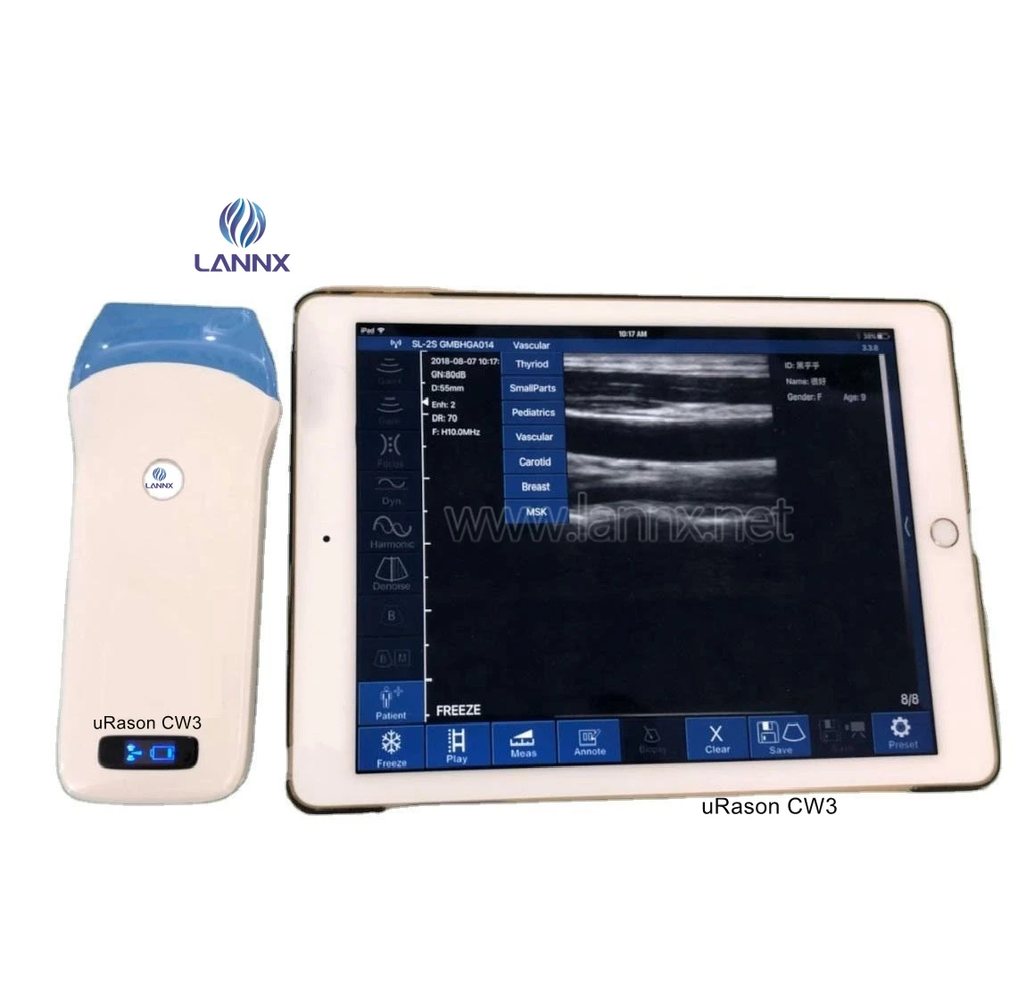 

LANNX uRason CW3 4d Color Doppler Pocket Ultrasound For Android Medical probe New type Wireless Wifi ultrasound