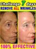 wrinkles disappear，20 years younger 1