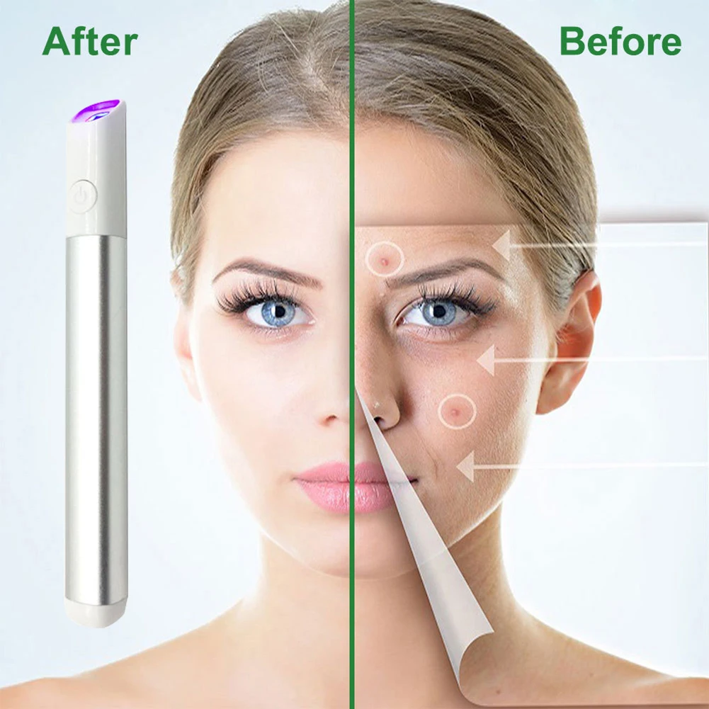 Portable Blue Light Therapy Acne Laser Pen Skin Spots Wrinkle Removal