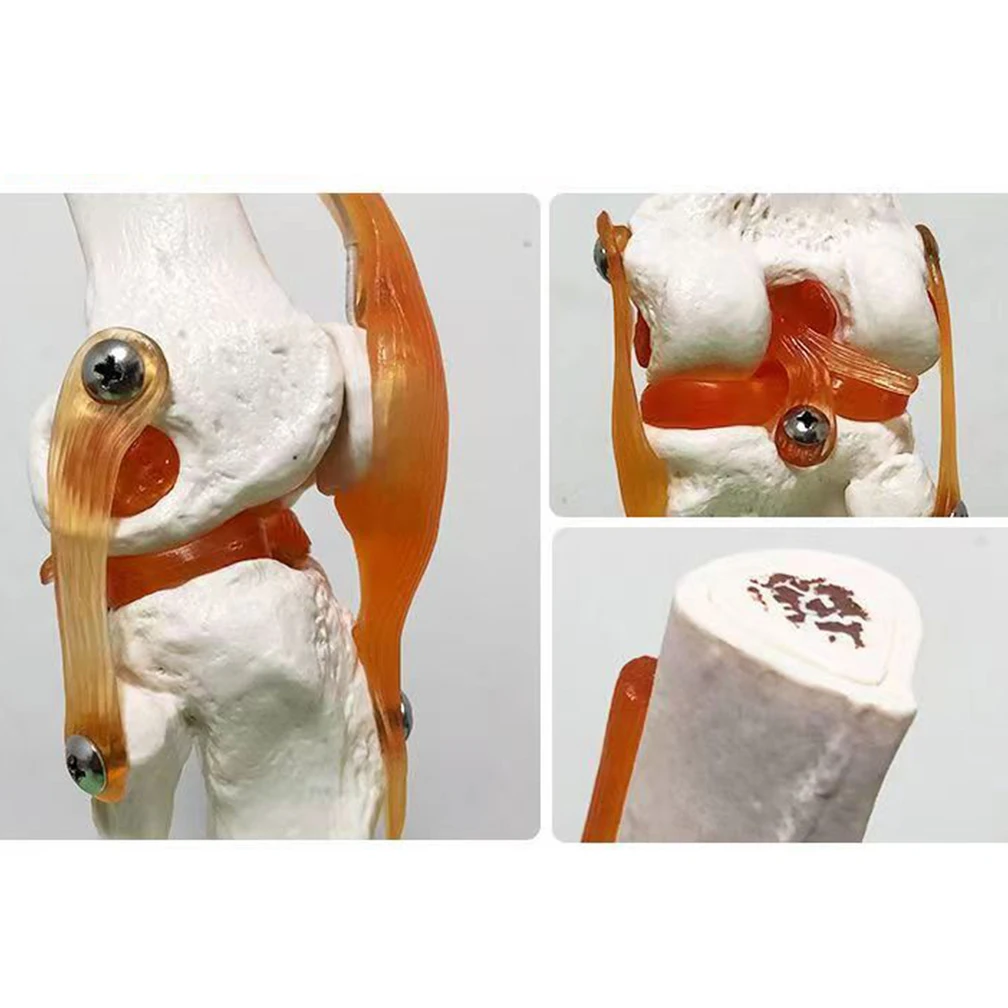1:1 Lifesize Adults Human Knee Joint Anatomy Model Medical Science Teaching Resources Anatomia Humana Supplies anatomical models