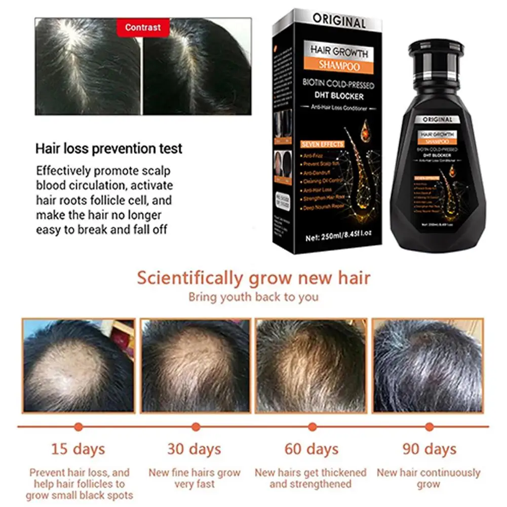 Essential Oil Biotin Cold-Pressed DHT Blocker Hair Conditioner Shampoo Anti-Hair Loss Accessori G9L6