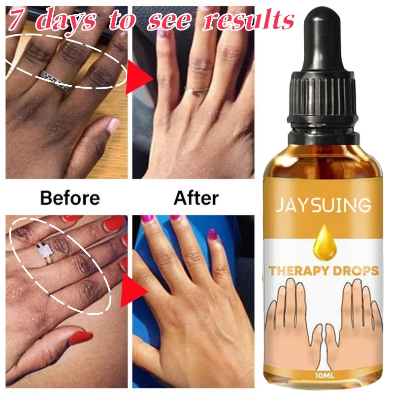 Facial Serum Facial Essence Whitening Serum Dark Knuckles Fast Brighten Serum Elbows Hand Knuckle Brightening Serum Knee Black Skin Spot Lighten Stains Remover Essence