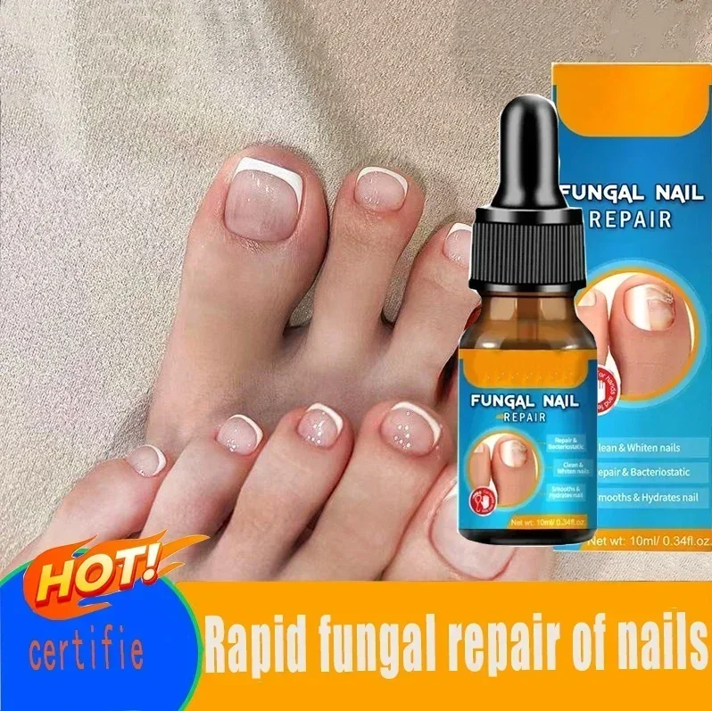 Toenail Nail Fungus Treatment image 3