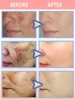 Anti-freckle essence, effectively removes dark spots, age spots, chloasma and freckles in 7 days 6