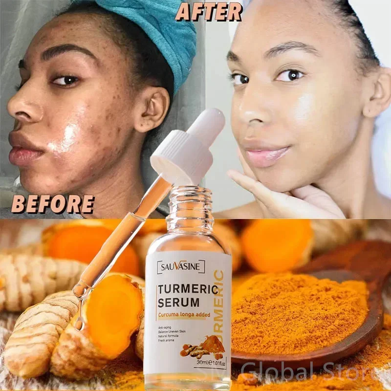 

Turmeric Whitening Freckles Facial Serum Cream Remove Dark Spots Melasma Lighten Melanin Acne Scar Anti-aging Brighten Skin Care