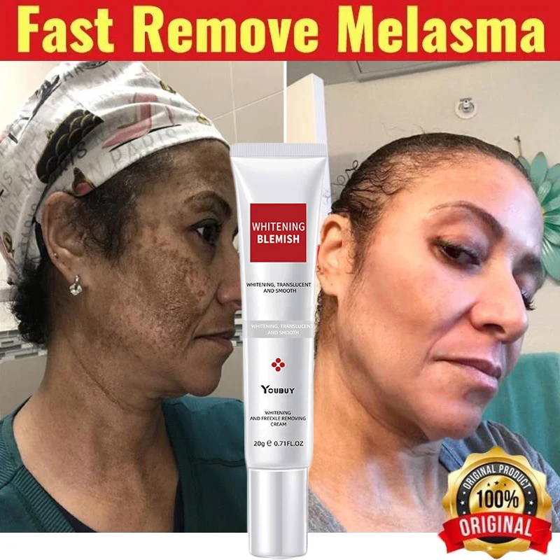 Whitening Freckle Cream Effective Remove Melasma Cream Remove Dark Spots Melanin Improve Dullness Brighten Body Face Skin Care