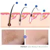 50g Hair Inhibitor Stop Hair Growth Removal Permanent Cream Beard Bikini Intimate Legs Body Armpit Lotioin Painless Depilatory 5