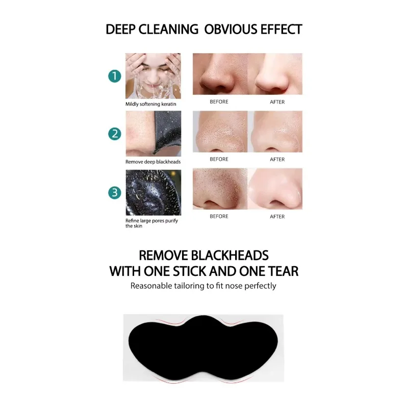 Luxury nose pore strips for blackhead removal, quick and easy acne treatment for sale, deep and refreshing skin cleansing strips.