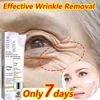 Retinol Remove Wrinkle Eye Cream Instant Firming Lifting Fade Fine Lines Eye Bags Anti Dark Circle Brightening Beauty Skin Care