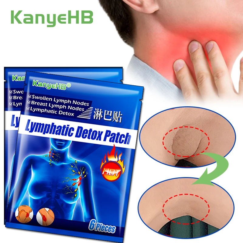 Herbal Lymph Nodes Patch Breast Lymphatic Drainage Plaster Effective Anti Swelling Neck Neck