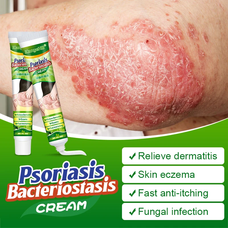 1pcs Private Part Anti-itch Cream Anal Itching Cream Psoriasis Glans Penis Itch Scrotal Eczema Odor Antifungal G024