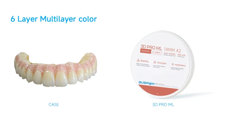 GUSROM 3D PRO Mehrschichtiger Zirkonoxid-Block 98mm A1 A2 A3 Offenes System 1050MPa Hohe Festigkeit 57% Transluzenz für CAD CAM Dental-Kronen – Detail 17