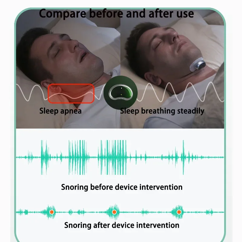 YA4300 smart anti-snoring home anti-snoring artifact nose snoring snoring fire