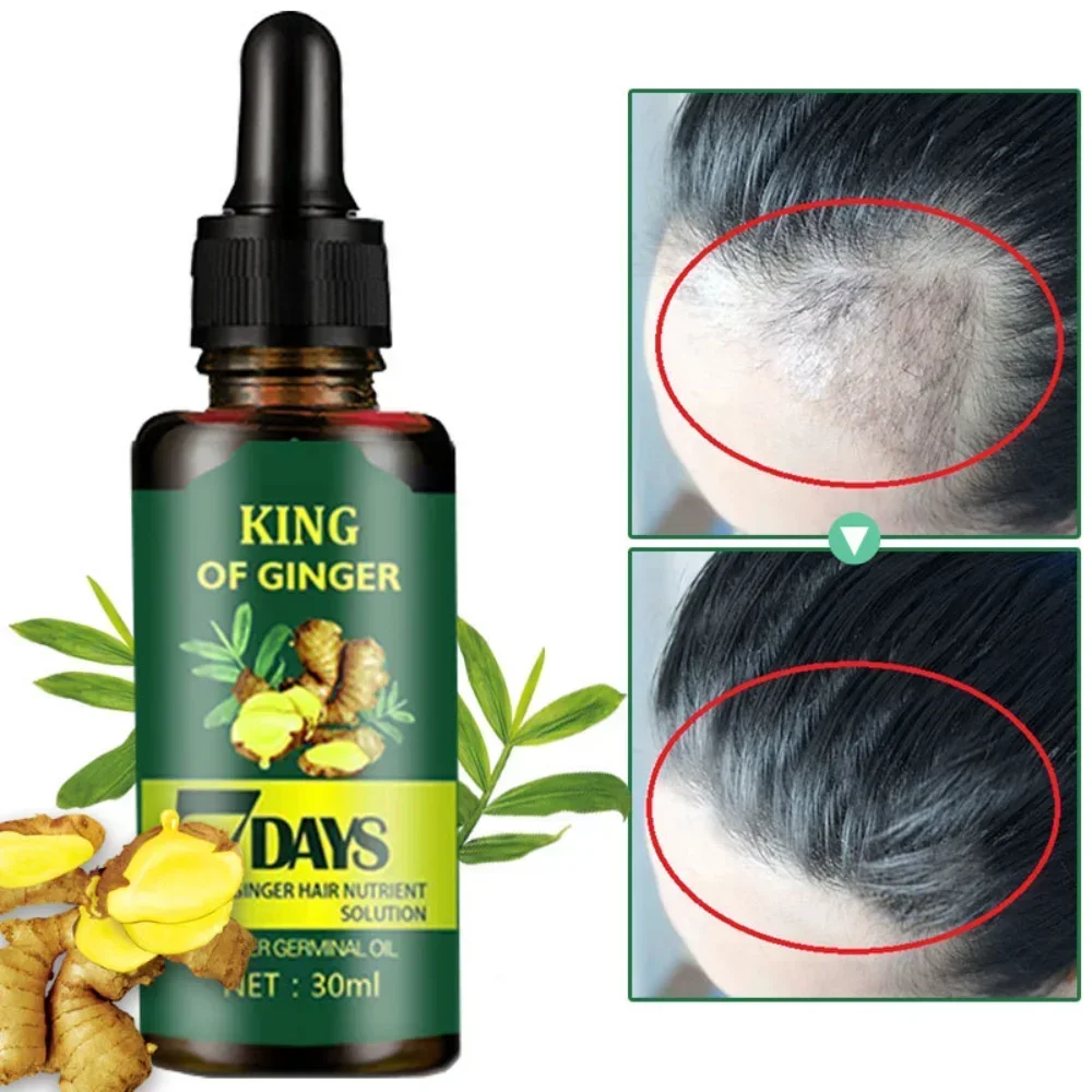 

King of Ginger Germinal Oil 30 мл 7 дней для защиты кожи головы от повреждения волос
