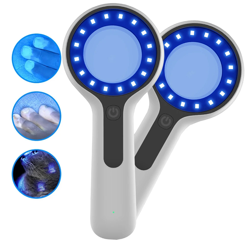 NEW Woods Lamp Skin Analyzer Portable Facial Salon Beauty Analyzer UV Lamp Wood Dermatology for Analyzing Testing Examination