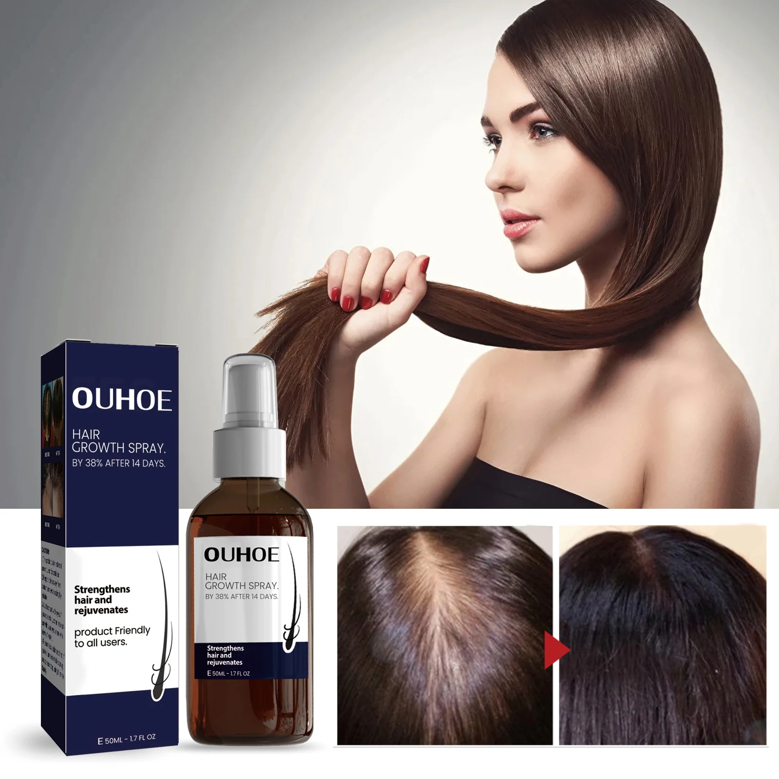 OUHOE Hair Growth Spray Designed To Strengthen Stop Hair Loss Natural Essence Repair & Strengthen Follicles Spray