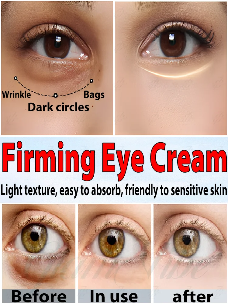 Eye cream anti wrinkle brightens and removes dark circles