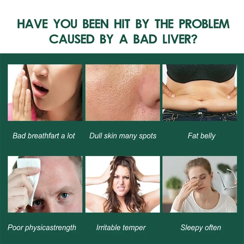 Liver Detox Cleanse Care Capsules Improve Liver Function Prevent Fatty Support Gallbladder Health