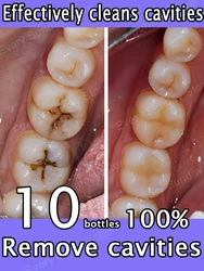 Clean cavities, whiten teeth, remove plaque, treat periodontitis, freshen breath, and let the whole family have good teeth