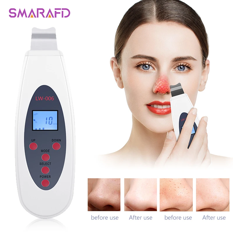 Ultrasonic Skin Scrubber Deep Face Cleaning Machine Removefacial