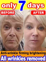 No wrinkles, 20 years younger 2