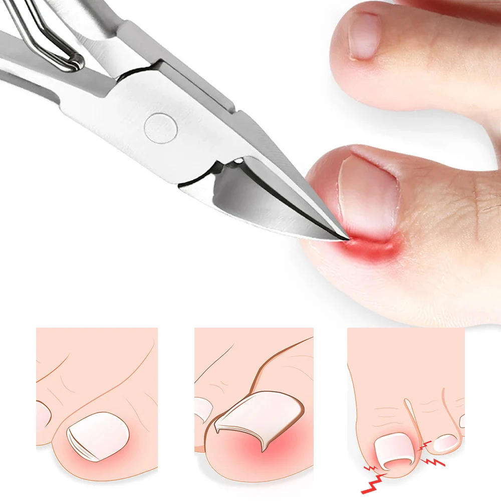 https://ae01.alicdn.com/kf/S7f6029b06a06491184295b54873cf8faw/New-Toenail-Clippers-Nail-Correction-Dead-Skin-Remover-Toe-Ingrown-Nipper-Cuticle-Scissors-Pliers-Pedicure-Care.jpg