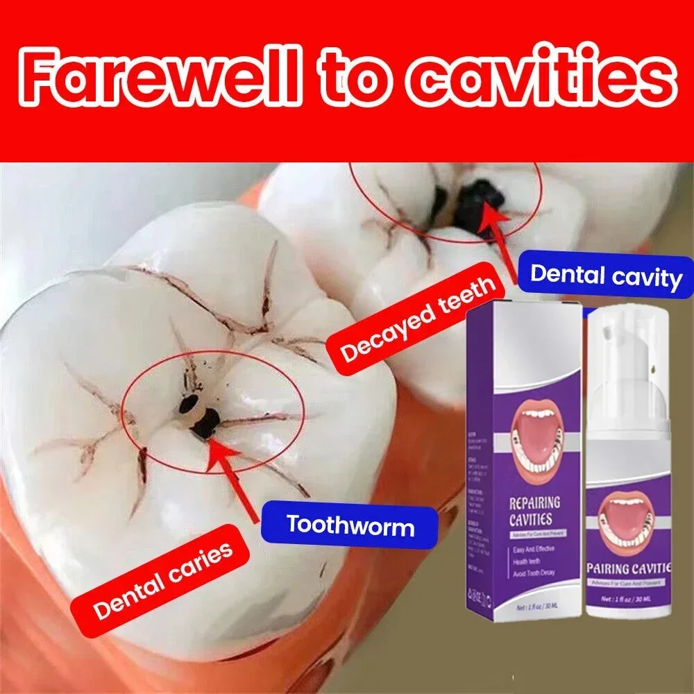 Effective Teeth Whitening Tooth decay repair Calculus Plaque Periodontitis Remove Cavities