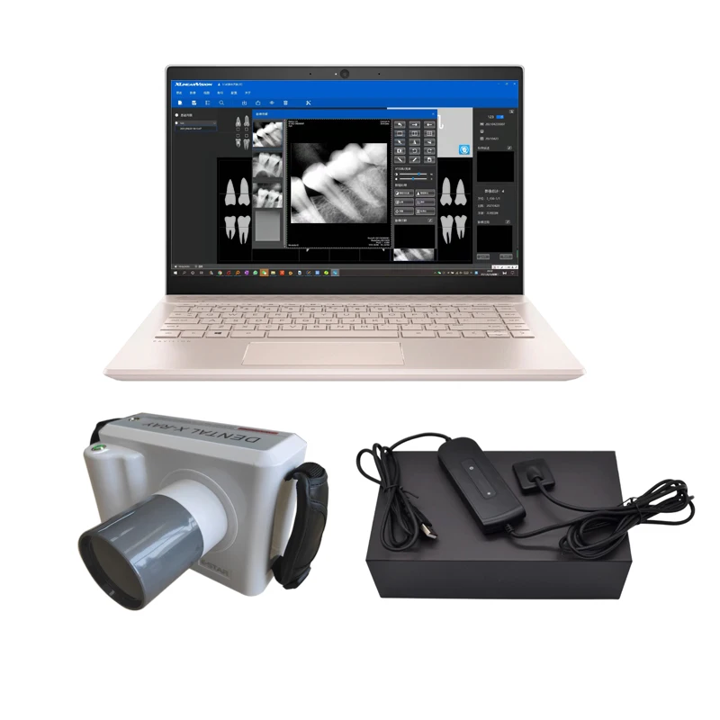 

Hot Selling USB Dental Intraoral X Ray Sensor with machine Imaging Set free System Cheap Price