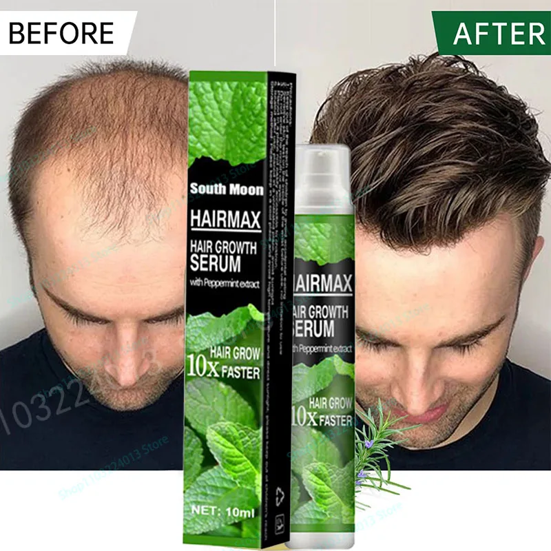 

Fast Hair Growth Growth Hair Oil Treatment Anti Hair Loss Men Women Scalp Treatment Serum Products Beauty Health