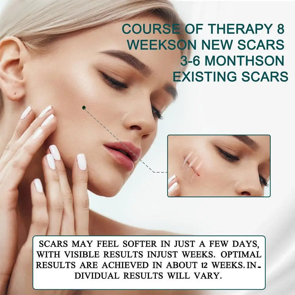 Acne Surgical Stretch Marks Removal Scar Cream Pimples Skin Acne Self-adhesive Tape Repair Tone Gel Spot Patch Face Burn E8L7