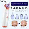 Blackhead Suction Instrument Remove Dead Skin Cells, Blackheads And Impuritie Cosmetic Face Acne Blackhead Cleanser 1