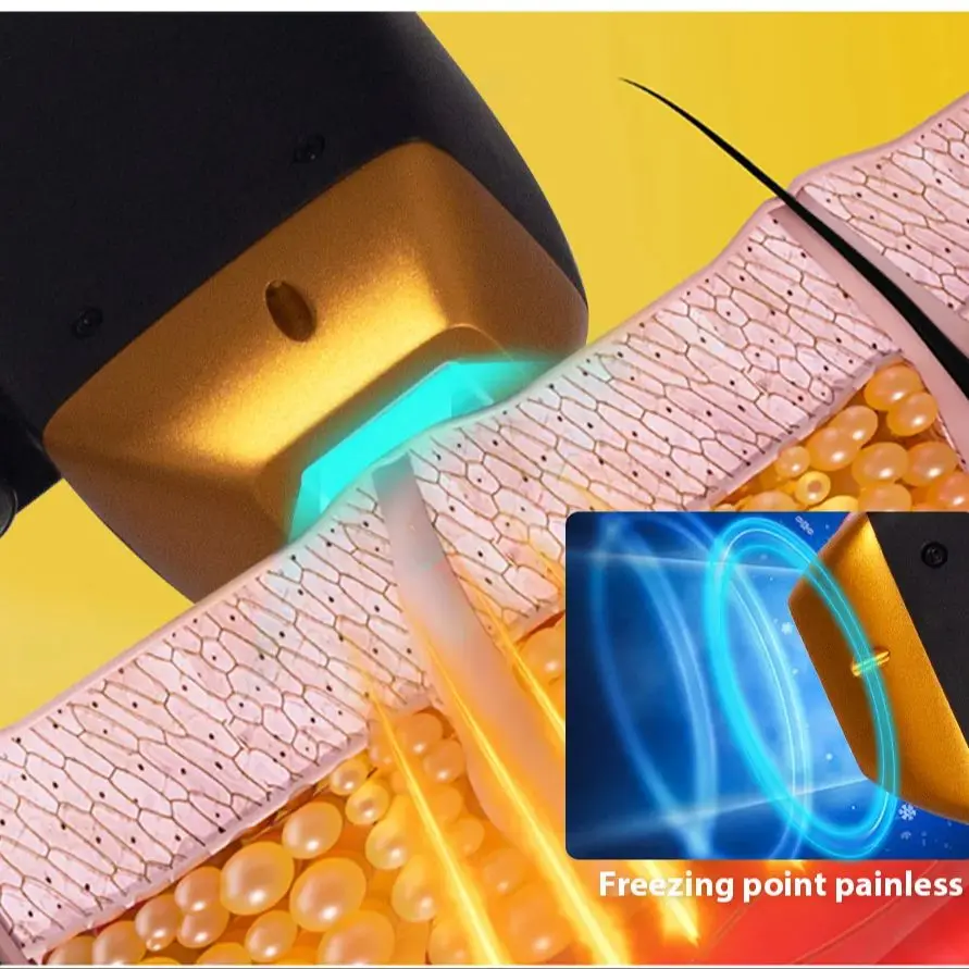 4000W 808nm Alexandrite Ice Diode Hair Removal - Image 3