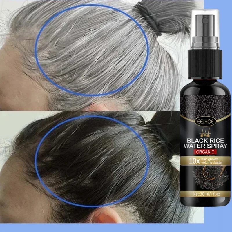 Hair Growth Serum Hair Growth Spray Hair Coloring Product Gray White Hair Treatment Serum White To Black Repair Natural Color Black Rice Nourish Spray Anti Loss Hair