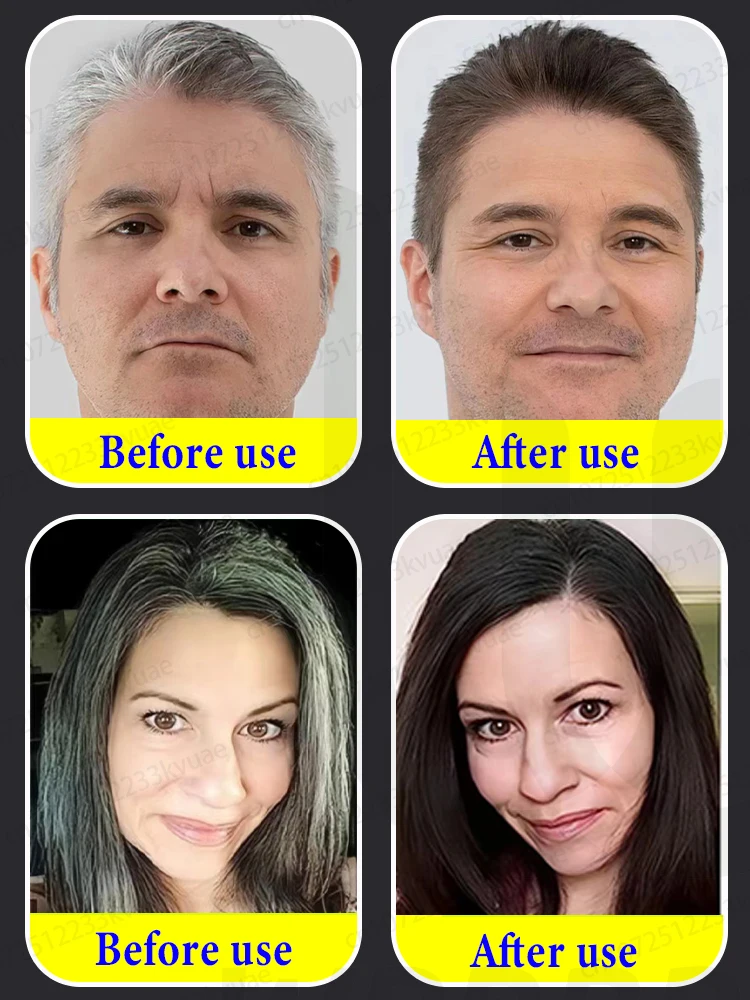 Pure natural anti-whitening extracts get rid of gray hair turn it into black hair from the roots