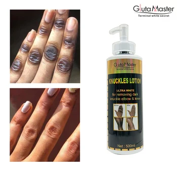 Gluta Master 얼룩 제거 바디 로션, 미백, 피부 미백, 너클, 무릎, 팔꿈치, 안티에이징, 스무딩 스킨 케어 제품