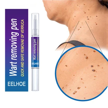 Wart Removal Mole Remedy Liquid Pen Treatment Papillomas Removing Skin Labels Flat Wart Genitals Painless Beauty Herbal Cream 6