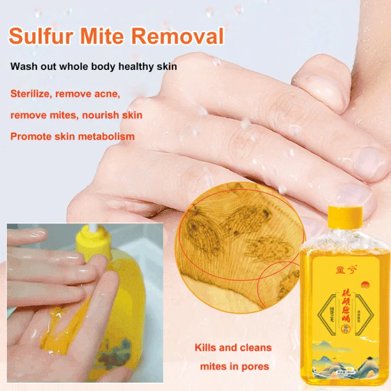 Sulfur Mite Removal Shower Gel