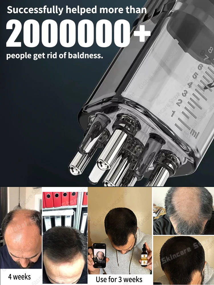 충격 2025 최신형 두피 마사지 도구, 두피 유도 마사지기, 오일 도포, 모발 성장 빗