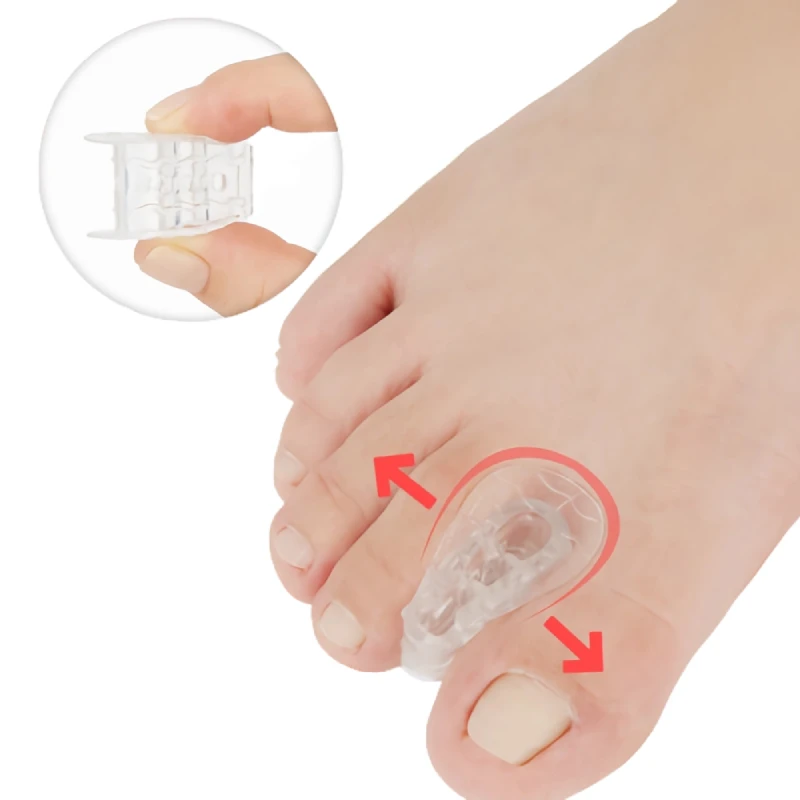 

2pieces=1pair Toe Orthosis Clip Pads Big Foot Bone Splitter Thumb Hallux Valgus Overlapping Silicone Separators Bunion Corrector