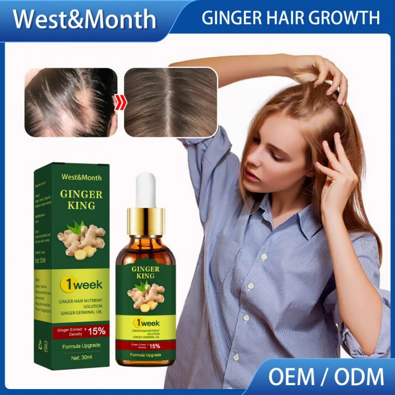 Moisturizing Formula Growth Serum Ginger Essential Oil Hair Care For Men  Ginger Germinal Oil Fast Hair Growth Anti Hair Loss|Men's Hair Loss  Products| AliExpress | Hair Regrow Ginger Germinal Essential Oil, Ginger
